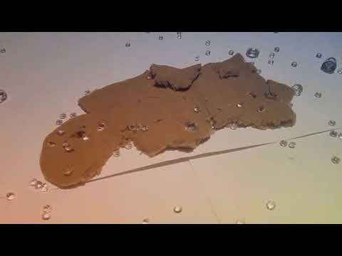 The Most Cringy Satisfyingly Unsatisfying Video You'll Ever Watch