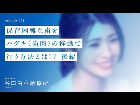第52話 保存困難な歯をハグキ（歯肉）の移動で行う方法とは⁉️後編-札幌駅前-赤れんがテラス-谷口歯科診療所