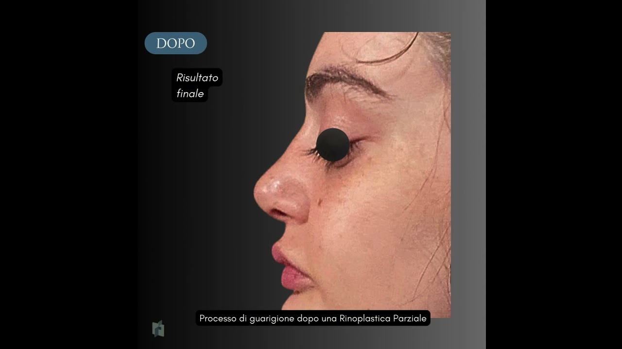 Fioravante Orefice-27