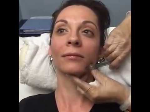 Botox Injection To Smooth Away Angry Facial Expression