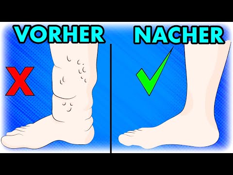 Abend-Routine gegen Lymphödem: 3 Übungen für Ü50 zur schnellen Linderung!