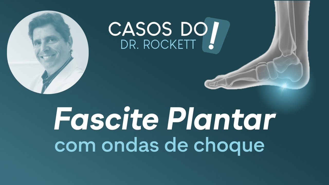 Fascite Plantar | Tratamento com Ondas de Choque | Dr. Paulo Rockett