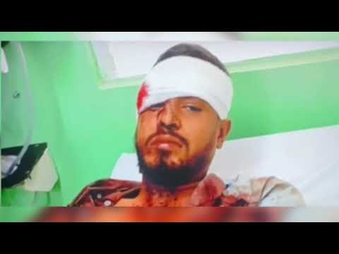 New Footage Shows Omar Avelar Kicking Officer; Minister of Home Affairs Weighs In