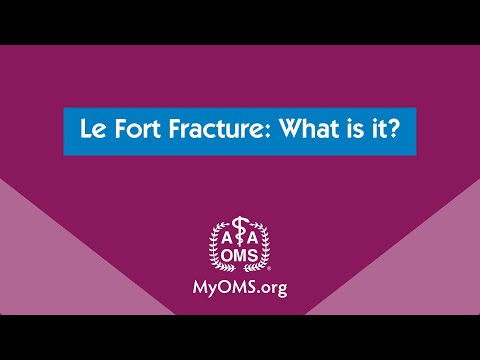 Le Fort Fracture: What is it?