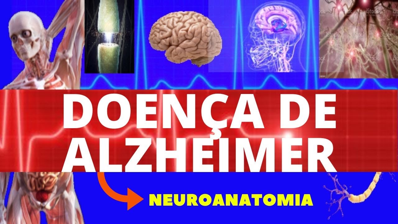 DOENÇA DE ALZHEIMER - (CAUSAS, SINTOMAS, DIAGNÓSTICO E TRATAMENTO) FISIOPATOLOGIA - NEUROLOGIA