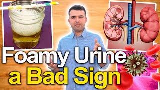 FOAMY URINE IS NOT A GOOD SIGN - Foam In Urine Might Indicate Kidney Damage or Insufficiency