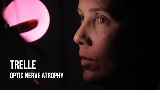 Trelle, Optic Nerve Atrophy | Stem Cell Treatment Testimonial