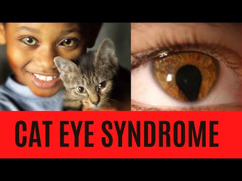 CAT EYE SYNDROME: Summary-Symptoms-Signs-Causes-Treatment-Diagnosis-Prognosis
