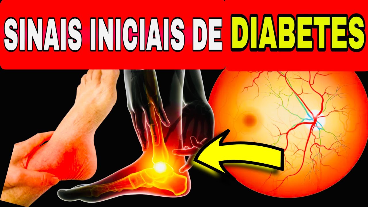 14 SINAIS INICIAIS e PERIGOSOS de DIABETES (Açúcar Alto no Sangue)
