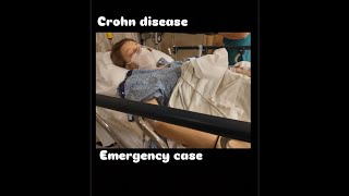 When to do surgery in crohn disease |mbbs