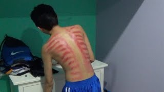 Download lagu KEROKAN / DIKEROKIN (INDONESIA TRADITIONAL HEALING MASSAGE) mp3