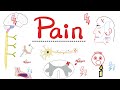 Pain Gate Theory Of Pain Sensory Nervous System CNS Opioids Pain Medications Neuro