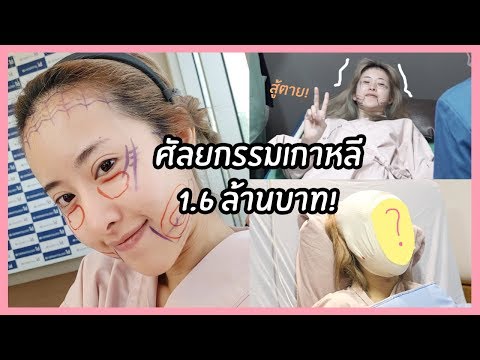ที่แรงจะเพิ่มขึ้น ปลิงเพื่อเพิ่มความแข็งแรง