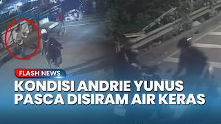 Aktivis KontraS Alami Luka Bakar 24%, Mata Andrie Yunus Harus Dioperasi Akibat Siraman Air Keras