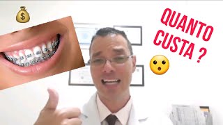 QUANTO CUSTA pra colocar APARELHO ORTODÔNTICO nos DENTES