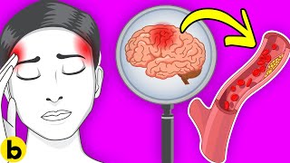 How To Get Migraine Relief & Headache Relief Without Pills