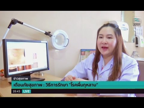 ราคามอสโก akrustal ครีมบนผิวของโรคสะเก็ดเงินจีน
