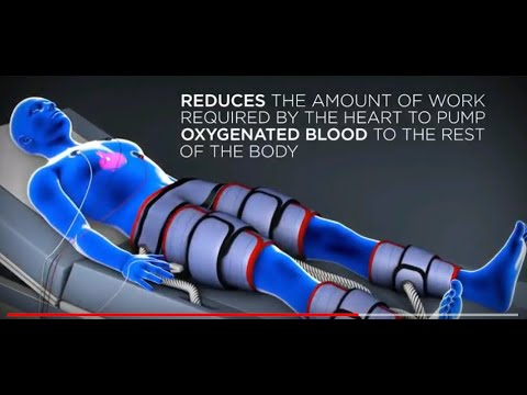 Errol Heart Ejection 17% to 65% Call 425 770 9466