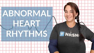 EKG - Abnormal Heart Rhythms