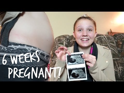 Week 6 Pregnancy Update│OUR FIRST ULTRASOUND! Video