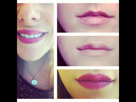 BPH Benigne Prostatahyperplasie Prostamol uno Preis Bryansk