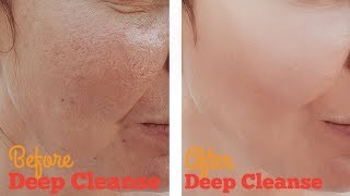 How to Deep Clean Facial Pores with Home Remedies
