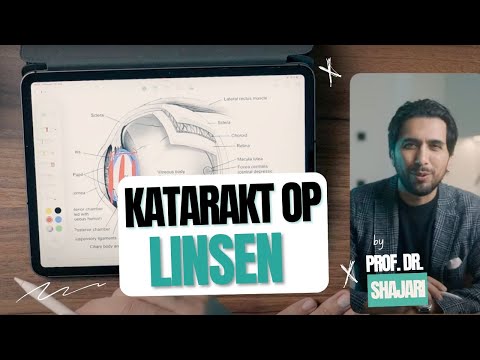 EVERYONE must see this video before their cataract surgery
