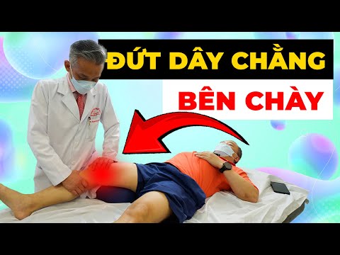 Đứt Dây Chằng Bên Chày: Khi Nào CẦN Phẫu Thuật? Bác Sĩ Giải Đáp Chi Tiết