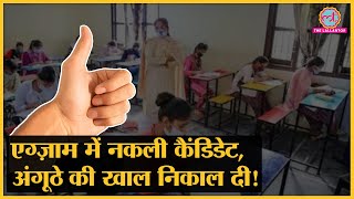 Railway Exam  में नकली कैंडिडेट ने बायोमैट्रिक से बचने को निकाली खाल, ऐसे पकड़ा गया