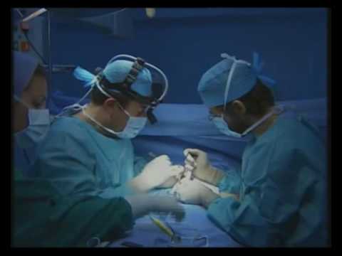 Breast Augmentation-UK-Greece=Cyprus-Dr Kapositas M.D,PhD,Global Plastic Surgery