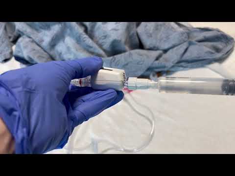 Intra Abdominal Pressure Monitor Video