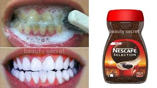 Teeth whitening in 1 minute/ removing the yellowness and tartar accumulated in the teeth,💯 effective