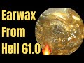 Earwax From Hell 61 0 ️