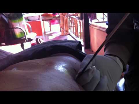 Bamboo Tattooing at Siam Tattoo in Koh Tao, Thailand HD720