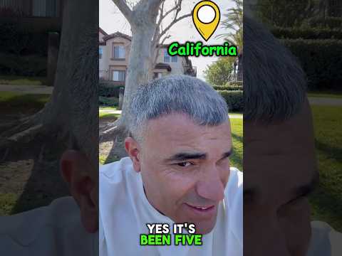 5.5 Months After My Hair Transplant – Real Growth & Progress #TurchCare #hairtransplant