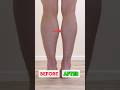 Slimmer LEGS, Reduce Swelling [5 MINS]