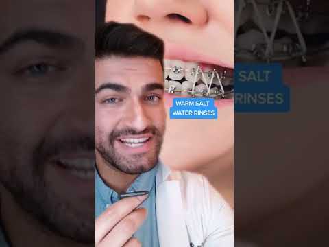 BRACES TIPS 🦷😩!? #shorts