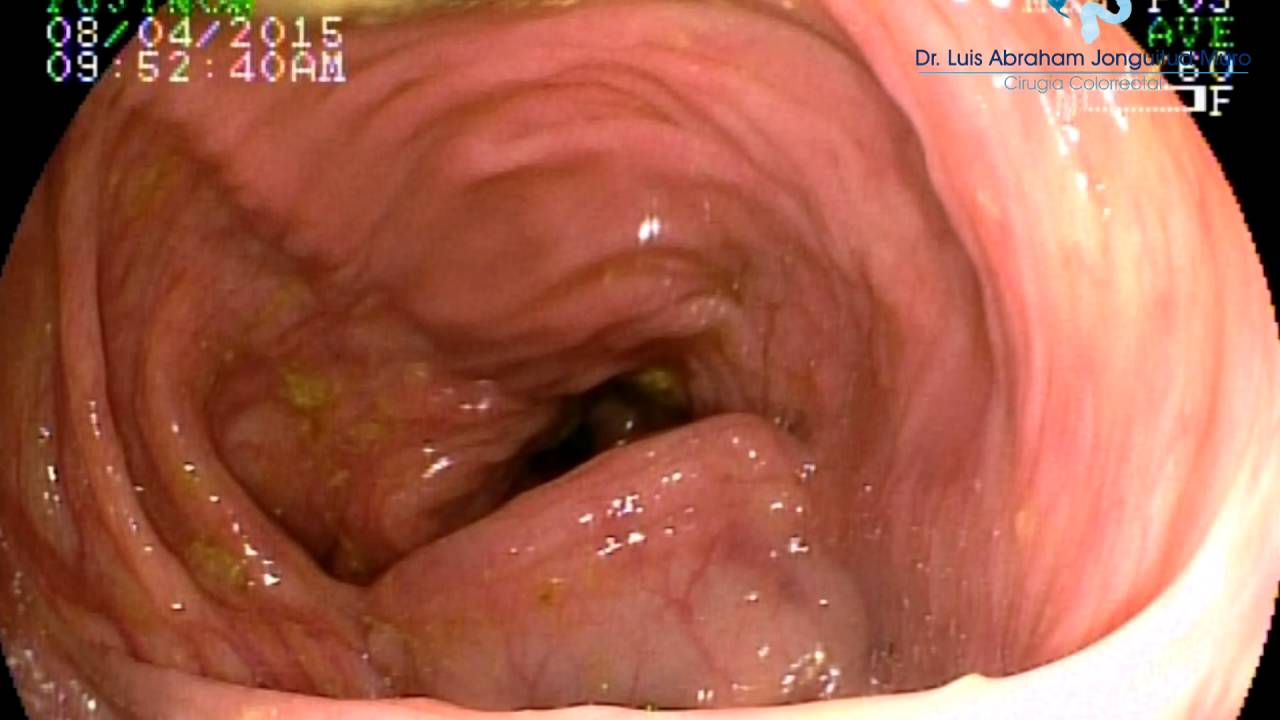 Luis Abraham Jonguitud Muro-6