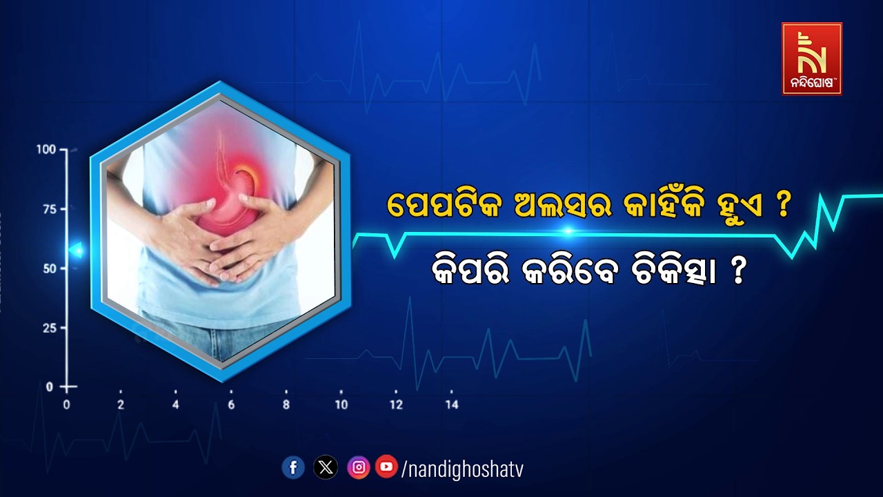 🔴 Live | ପେପଟିକ ଅଲସର କାହିଁକି ହୁଏ ? କିପରି କାରିବେ ଚିକିତ୍ସା ? 