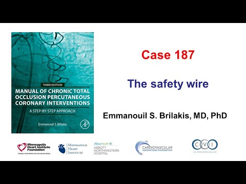 Case 187: Manual of CTO PCI - The safety wire