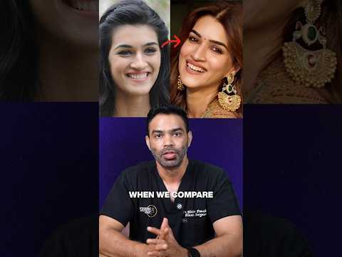 Have you noticed Kriti Sanon’s smile makeover?