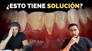 Encía inflamada, sangrante, llena de sarro y mal aliento. ¿Hay solución