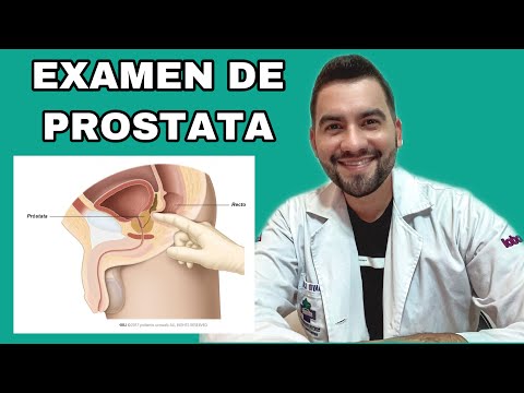 WHY MEN ARE AFRAID OF UROLOGISTS / PERSONAL DIAGNOSIS / PROSTATE | DAVID CAMPOS