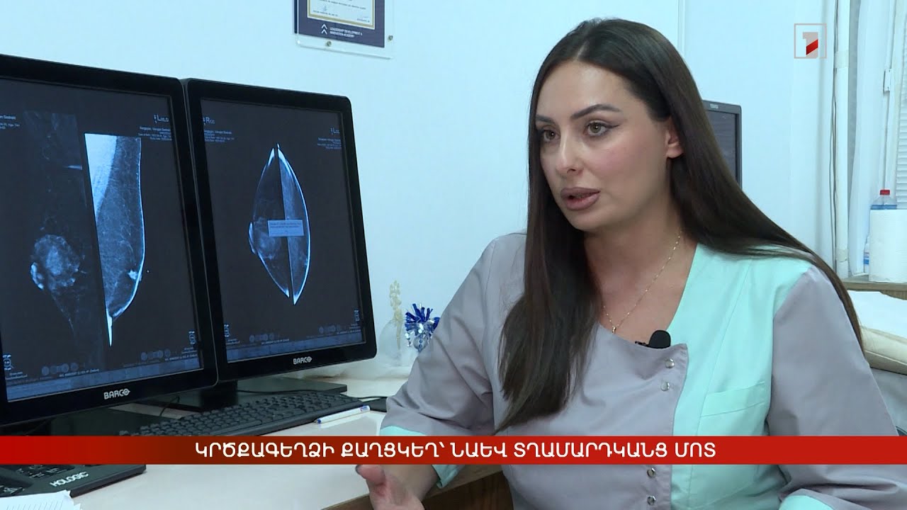 Կրծքագեղձի քաղցկեղ՝ նաև տղամարդկանց մոտ