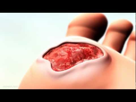 ColActive Plus - BioActive Collagen Matrix Dressing