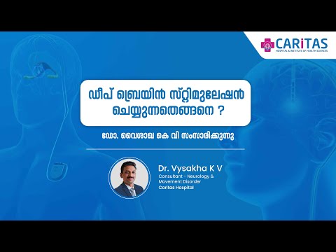 How is deep brain stimulation done? | Dr. Vysaka KV I Caritas Hospital