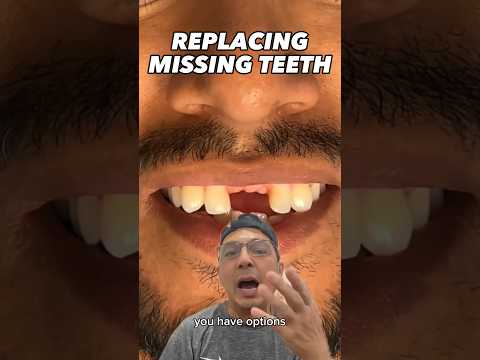 Options to Replace Missing Front Teeth | View Mobile Dental #shorts