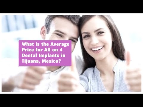 Watch the Average Price for All on 4 Dental Implants in Tijuana, Mexico?