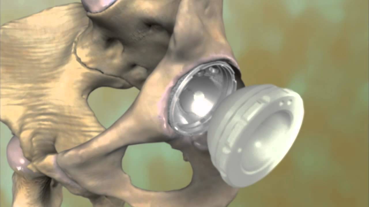 Miguel Hernández Contreras-7