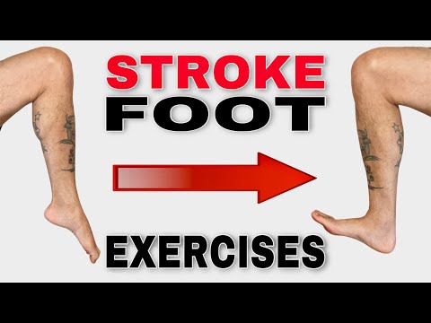 Spastic Foot Exercises and Stretches